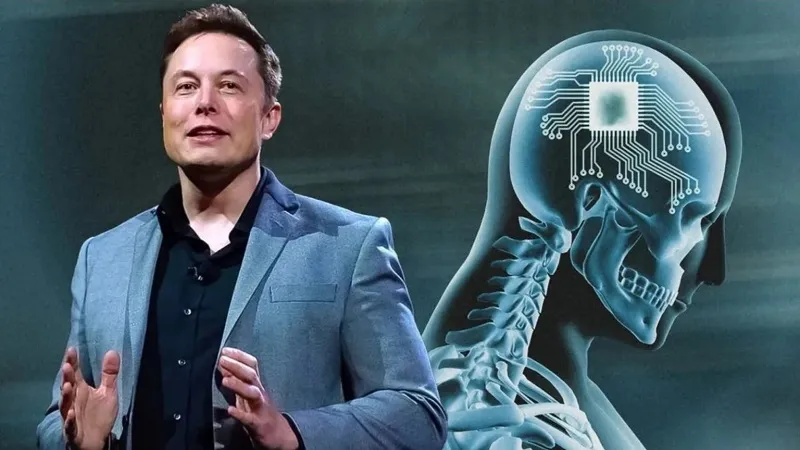 Apresentação do Neuralink Elon Musk 2016